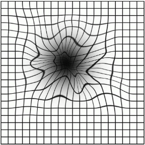 The Amsler Grid, Westside Eye Clinic